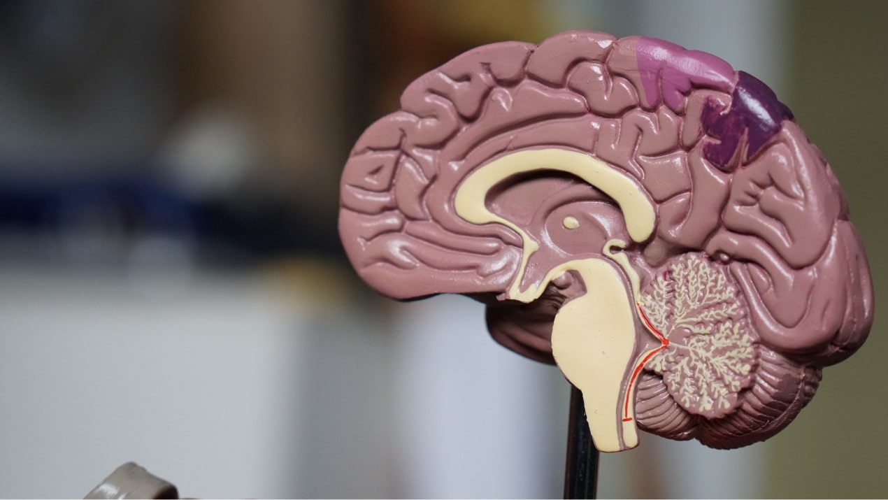 Efficacy and safety of oral citicoline in acute ischemic stroke