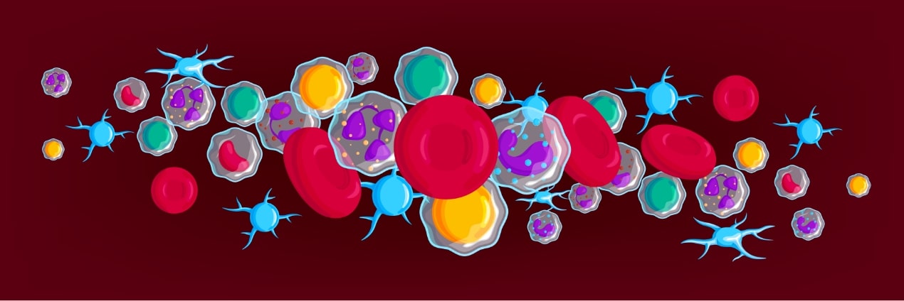 Efficacy and tolerance of an amphotericin B lipid (Intralipid) emulsion in the treatment of candidemia in neutropenic patients